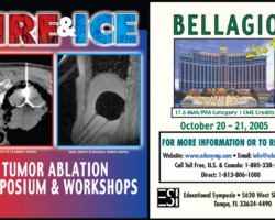Tumor Ablation (Ad)