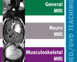 MRI Updates Brochure MRI Updates